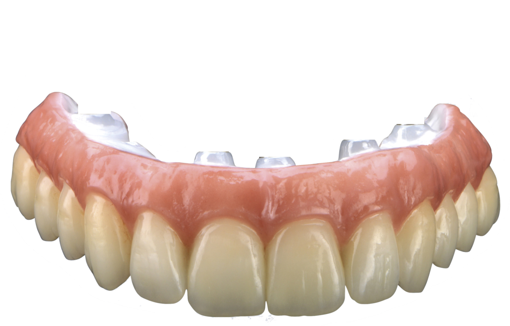 implant dentures, crowns, emax monolithic, zirconia crowns, veneers occlusal splints