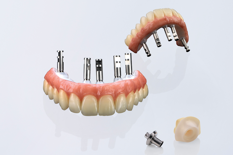 implants, implant dentures, crowns, emax monolithic, zirconia crowns, veneers, occlusal splints